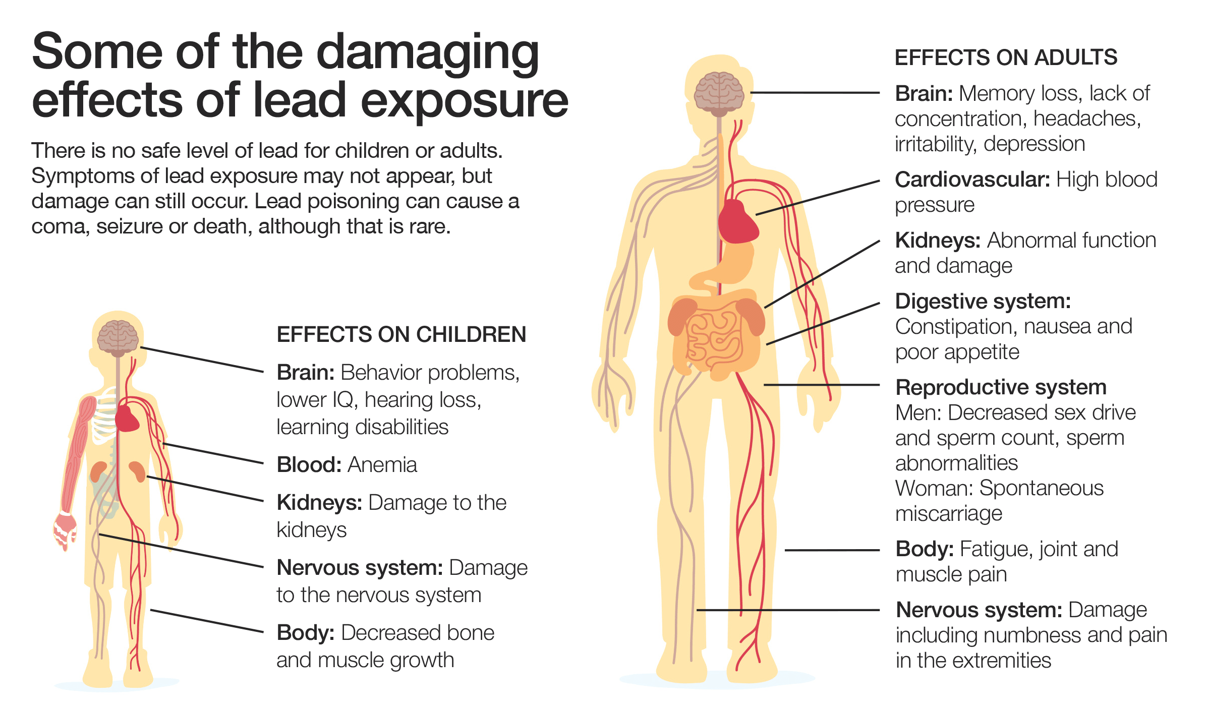 lead poisoning in adults
